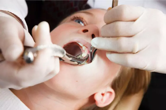 Dental Extraction Kallangur